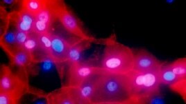FILE - This undated fluorescence-colored microscope image made available by the National Institutes of Health in September 2016 shows a culture of human breast cancer cells.