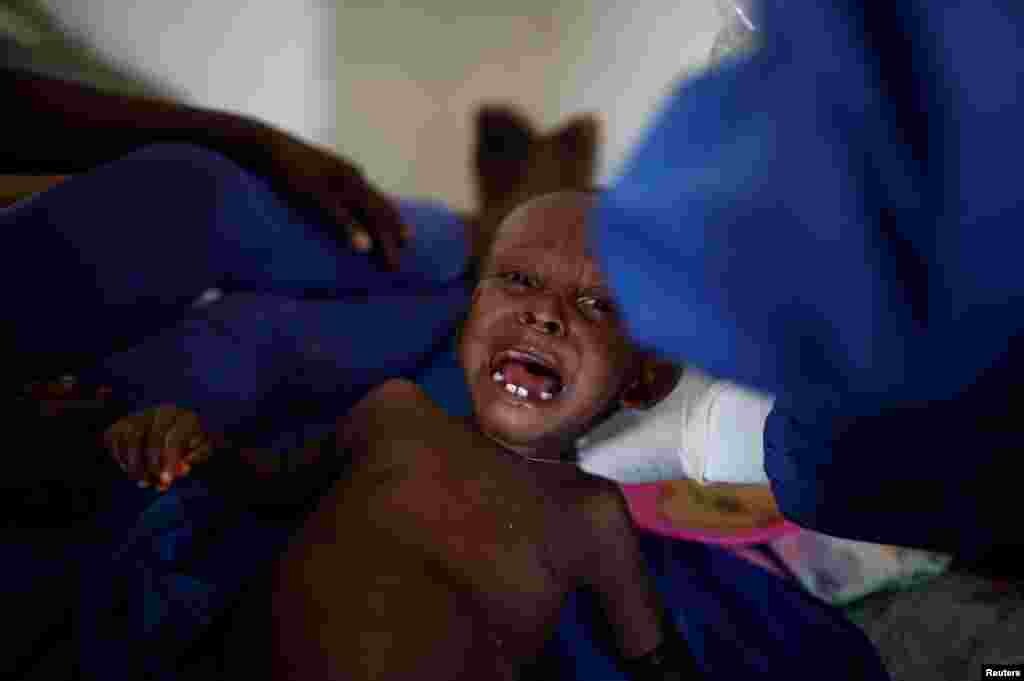 این کودک برای بیماری وبا، در مرکز پزشکی در هائیتی تحت درمان قرار دارد.