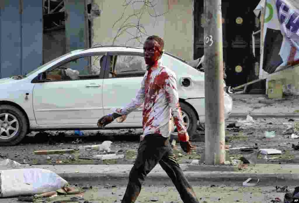 An injured civilian walks away from the scene after being wounded in a bomb blast near the Sahafi hotel in the capital Mogadishu, Somalia.