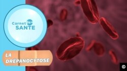 Sickle Cell