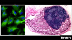 Image is of replacement thymus tissue. (MRC Center for Regenerative Medicine, University of Edinburgh)