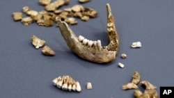 Bone fragments of Capt. William West are displayed at the Smithsonian's National Museum of Natural History in Washington, July 28, 2015.