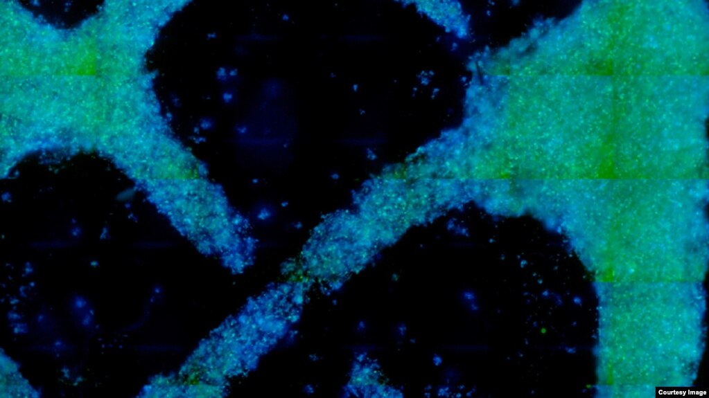 This image shows growth progress in an experiment, conducted by a research team from the Massachusetts Institute of Technology (MIT), to grow a wood-like structure in a laboratory from cells taken from a zinnia plant. (MIT/Microsystems Technology Laboratory)