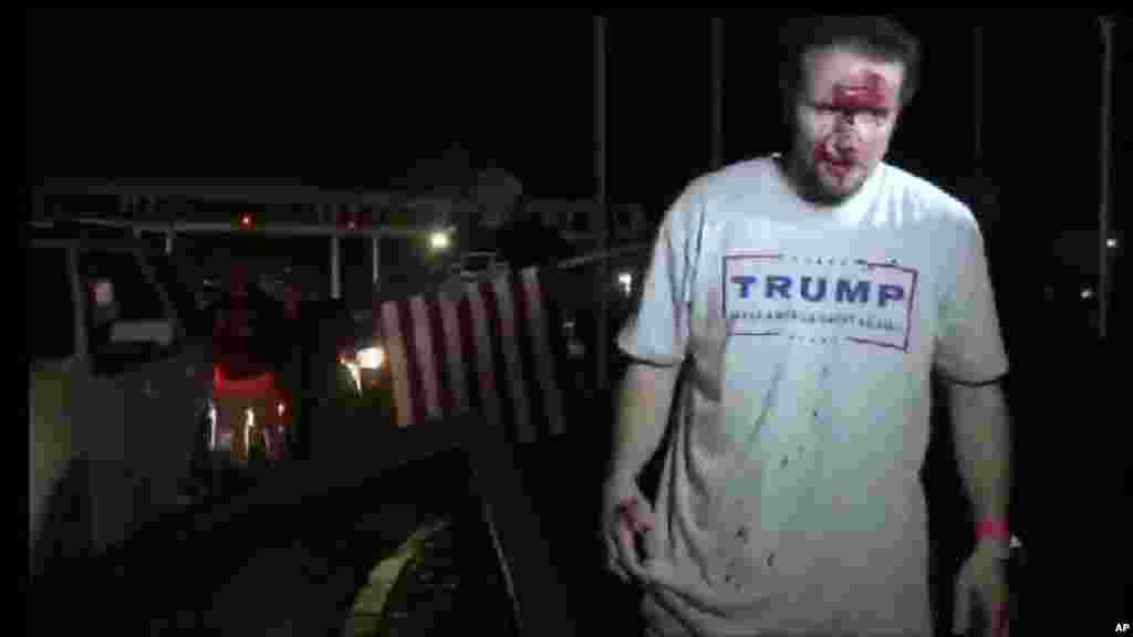 Un partisan du candidat républicain Donald Trump blessé après une manifestation le 28 avril 2016.