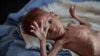 FILE- a severely malnourished boy rests on a hospital bed at the Aslam Health Center, Hajjah, Yemen.