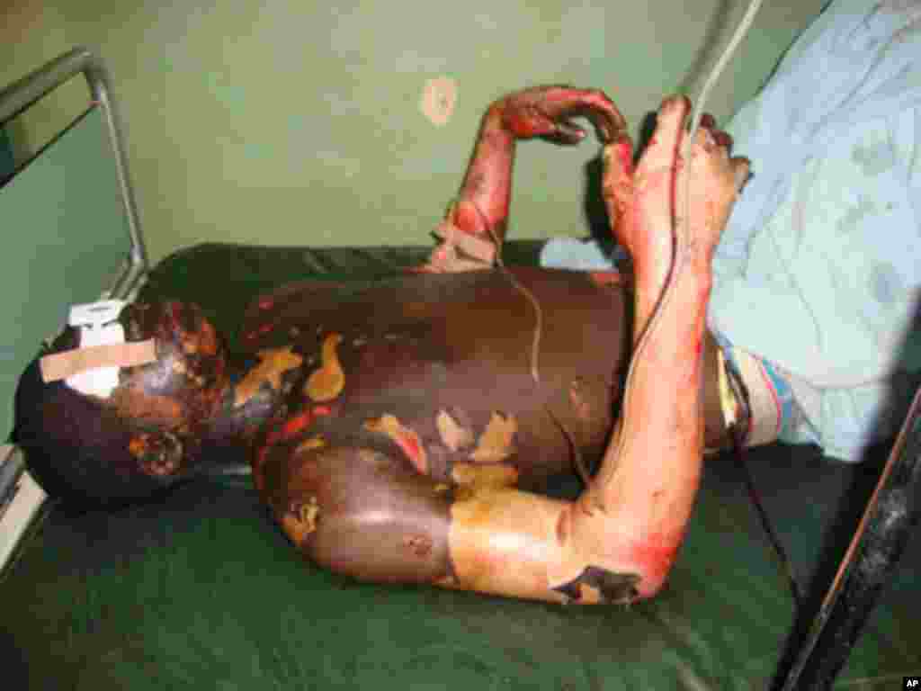 One of the surviving victims.