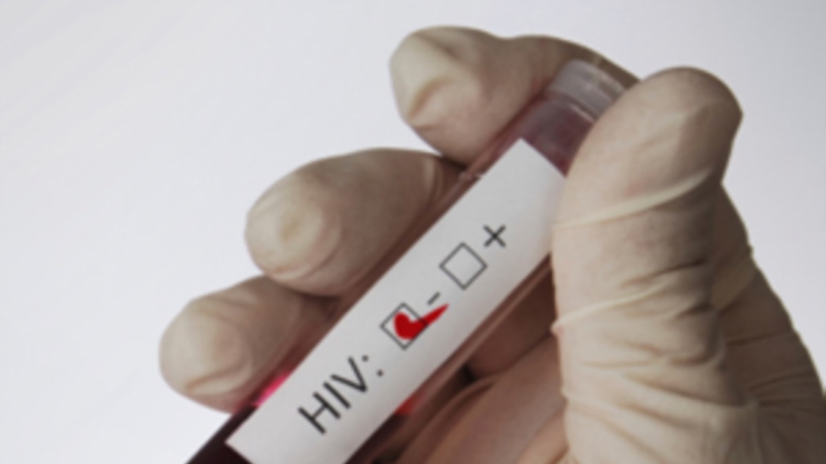 el virus del sida y sus partes