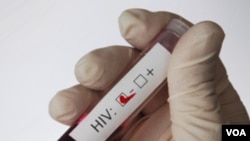 La principal fuente de transmisión del VIH es el contacto sexual con una pareja infectada.
