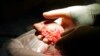 Keberhasilan Biorekayasa Ginjal Tikus Beri Harapan Regenerasi Organ Tubuh