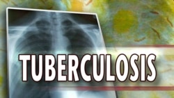 Doentes com tuberculose abandonam tratamento em Moçambique