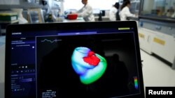 FILE - A monitor shows a three-dimensional image of a human heart at the Klaus-Tschira-Institute for Integrative Computational Cardiology, department of the Heidelberg University Hospital, in Heidelberg, Germany, Aug. 14, 2018. 