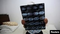 Seorang pasien perempuan pengidap kanker memegang hasil CT scan di sebuah rumah sakit di Beijing (foto: ilustrasi).