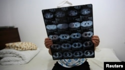 A Mongolian woman holds up her CT scan film in a hospital in Beijing, June 22, 2016. The woman was being treated for rectal cancer.