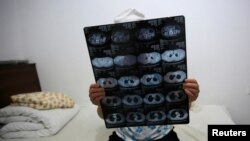 “Diagnosticar el cáncer en las últimas etapas y la incapacidad de brindar tratamiento condena a mucha gente a un sufrimiento innecesario y a la muerte temprana”, dice un experto de la OMS.