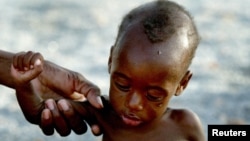 FILE - A mother holds on to her emaciated infant at an emergency feeding clinic in Maradi, Niger.