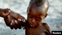 FILE - A mother holds on to her emaciated infant at an emergency feeding clinic in Maradi, Niger.