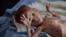 FILE- a severely malnourished boy rests on a hospital bed at the Aslam Health Center, Hajjah, Yemen.