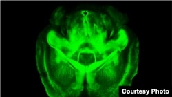 A three-dimensional rendering of clarified brain (Courtesy of the Deisseroth lab)