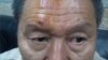 董继勤头部被打伤