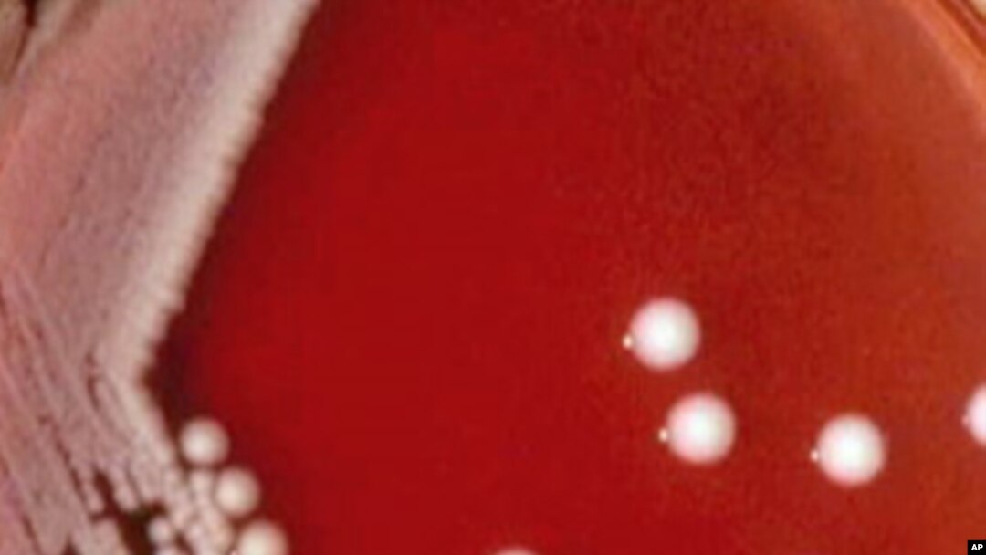 Carbapenem-resistant Klebsiella pneumoniae bacteria