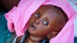 FILE - Malnourished Tiere Pascol, 5 months, whose mother can't afford food and has trouble breastfeeding, lies in his mother's arms at a feeding center in Al Sabah Children's Hospital in Juba, South Sudan, Dec. 3, 2020. 