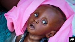 FILE - Malnourished Tiere Pascol, 5 months, whose mother can't afford food and has trouble breastfeeding, lies in his mother's arms at a feeding center in Al Sabah Children's Hospital in Juba, South Sudan, Dec. 3, 2020. 