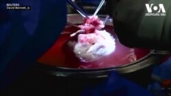 ღორის გული ადამიანის ორგანიზმში - სტუდია ვაშინგტონი