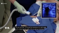 ڕێگاییەکی نوێ بۆ لەناوبردنی گرێکانی شێرپەنجە