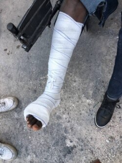 Johnny Fils Aime, a reporter for Radio Kajou in Port-au-Prince, was treated for two broken bones in his leg after an encounter with police while covering an anti-government protest in Port-au-Prince, Haiti, Feb. 9, 2021. (Matiado Vilme / VOA)