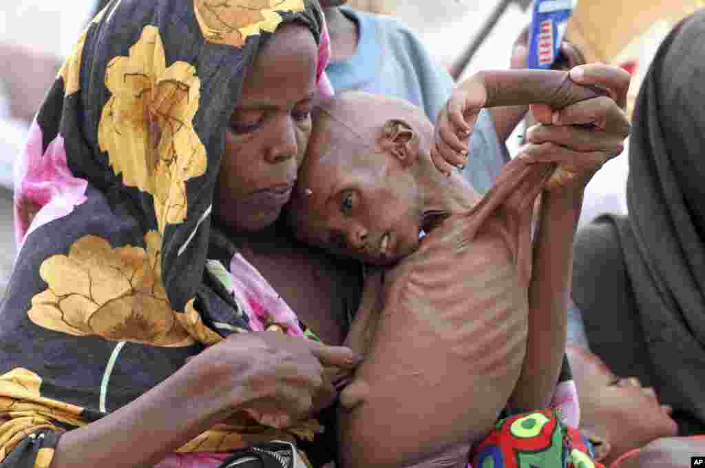 An internally displaced Somali woman holds her malnourished child while awaiting medical attention at Al-Adala settlement in Mogadishu, August 11, 2011. (Reuters)