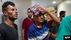 Un hombre herido en un bombardeo israelí es atendido en el hospital Nassr en Jan Yunis, en el sur de la Franja de Gaza, el 9 de julio de 2024.