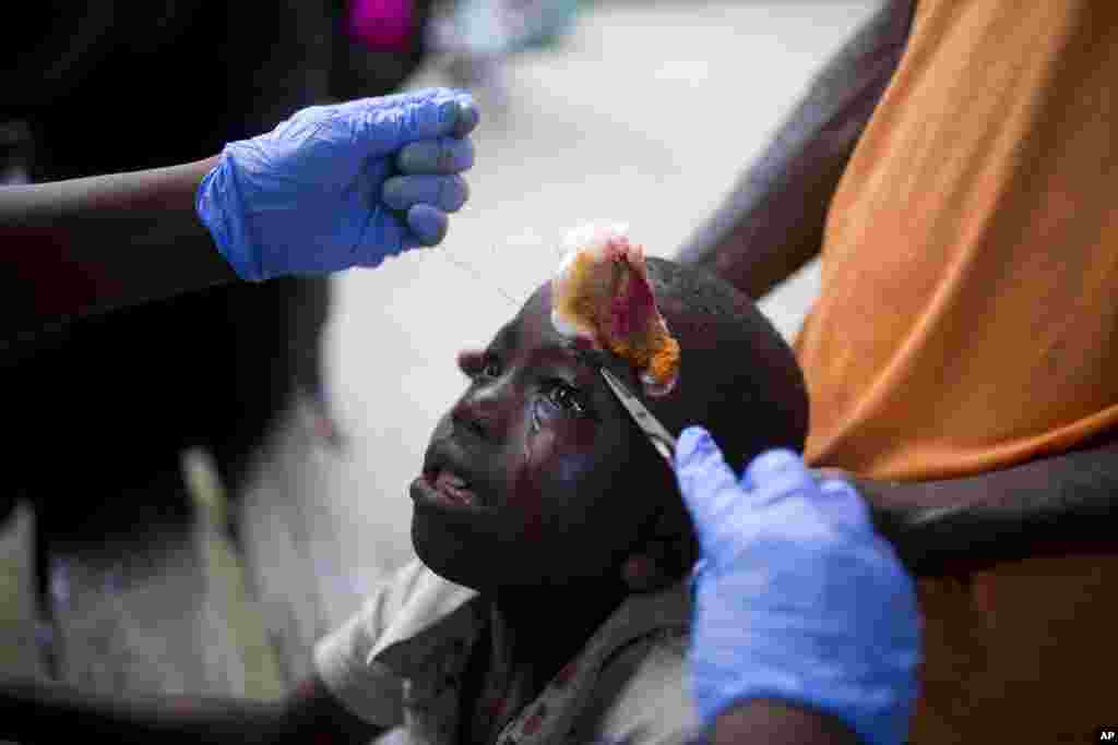 A boy that was injured by an aftershock receives treatment at the general hospital in Port-de-Paix, Haiti, Oct. 7, 2018. A magnitude 5.2 aftershock struck Haiti, even as survivors of the previous day&#39;s temblor were sifting through the rubble of their cinderblock homes.