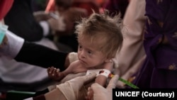 During a mobile health and nutrition team visit in Nasaji village, a nutrition nurse measures arm circumference of a child to determine their nutritional status in Nasaji village in Kandahar province, Afghanistan.