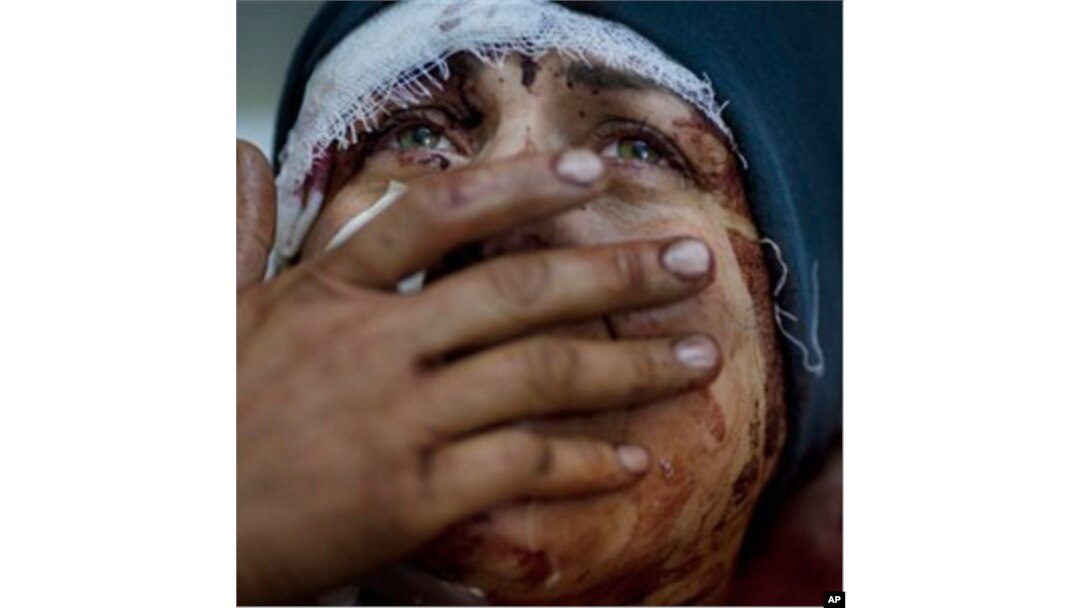 Zo'ravonliklardan omon qolgan suriyalik. Hims va Idlib shaharlari - hukumat kuchlari va muxolifat orasidagi jang maydoni.