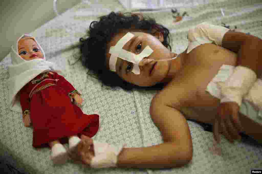Four-year-old Palestinian girl Shayma Al-Masri, who hospital officials said was wounded in an Israeli air strike that killed her mother and two of her siblings, lies on a bed next to her doll as she receives treatment at a hospital, in Gaza City, July 14, 2014.