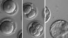 First Human Embryo Gene-Fix Could Help Stop Disease