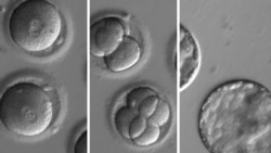 Quiz - First Embryo Gene Fix Could Help Stop Disease