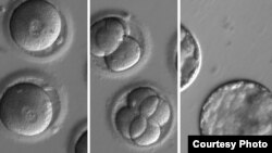 This sequence of images shows the development of embryos after co-injection of a gene-correcting enzyme and sperm from a donor with a genetic mutation known to cause hypertrophic cardiomyopathy. (Photo courtesy of OHSU)