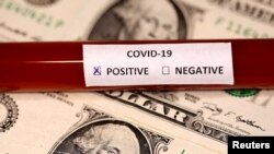 Ampul tes Covid-19 diletakkan di atas uang kertas dolar AS, 1 Maret 2020. (Foto: Reuters)