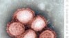 مشاوران کاخ سفید: آنفلوآنزای خوکی تهدید جدی را متوجه سلامت مردم کشورمی کند