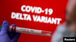 Seseorang tampak memegang tabung kecil bertuliskan "Hasil Tes Positif COVID-19" di depan di dinding yang bertuliskan varian delta COVID-19 dalam sebuah foto ilustrasi yang diambil pada 31 Agustus 2021. (Foto: Reuters/Dado Ruvic)