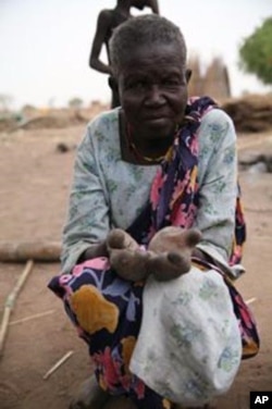 FILE - A woman, hands disfigured by leprosy and with no means of support, begs for food or any other offerings that can help her survive at a leper colony outside Juba, South Sudan’s capital.