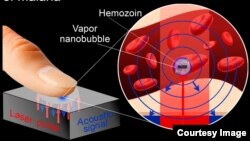 A newly-developed device detects malaria infection using laser pulses.