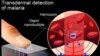 Laser Scanner Detects Malaria Infections in Seconds