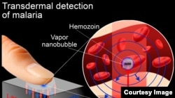 A possible rapid, non-invasive test for malaria infection detects tiny vapor nanobubbles produced by the malaria parasite when it is zapped by a short laser pulse. (Rice University)