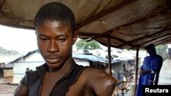 An 18-year-old man with amputated hands looks on at a camp for amputees in Freetown, July 21, 2003.
