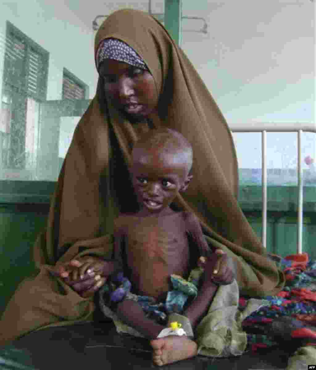 A Somali woman from southern Somalia hold her malnourished child in Banadir hospital in Mogadishu, Somalia, Thursday, July 21, 2011. Somalia's 20-year-old civil war is partly to blame for turning the drought in the Horn of Africa into a famine. Analysts w