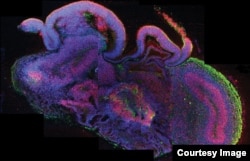 A cross-section of an entire organoid showing development of different brain regions. All cells are in blue, neural stem cells in red, and neurons in green. (Credit: Madeline A. Lancaster)