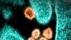 美国国家过敏症和传染病研究所提供的电子显微镜下的SARS-CoV-2病毒照片。（图片来源：AFP Photo/NIAID）