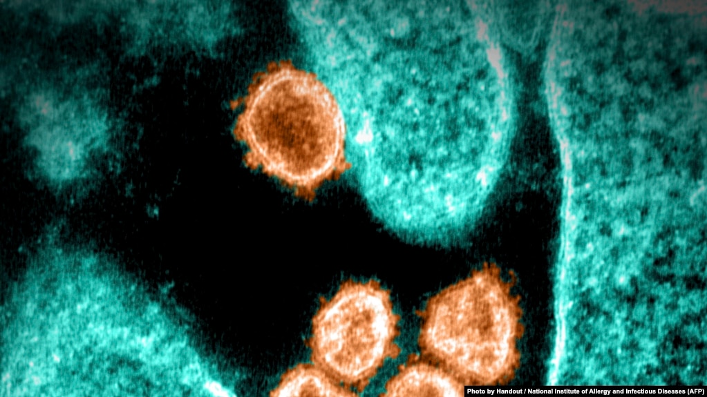 美国国家过敏症和传染病研究所提供的电子显微镜下的SARS-CoV-2病毒照片。（图片来源：AFP Photo/NIAID）(photo:VOA)